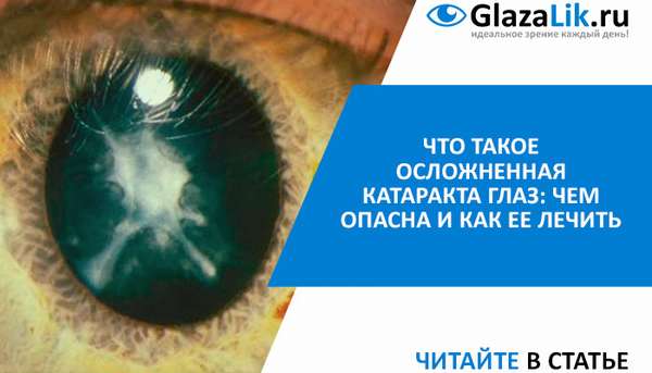 что такое осложненная катаракта